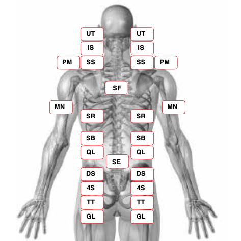 Intrinsic Biomechanics screening chart showing muscle groups on the back of the body